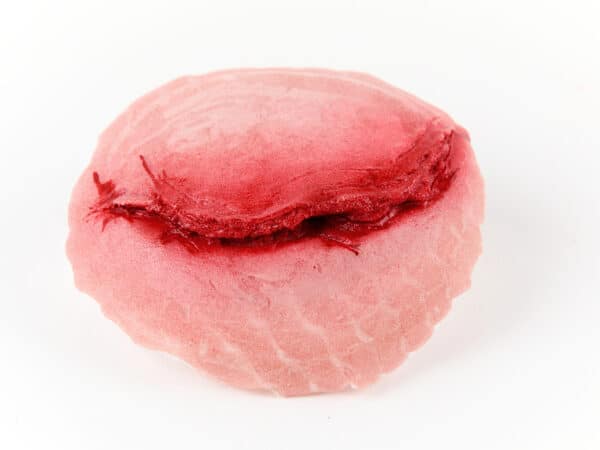 PLAIE “SCALP”